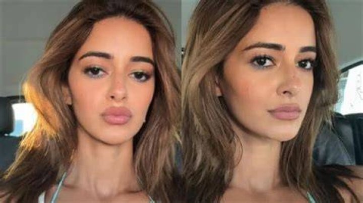 The Truth About Alanna Panday's Plastic Surgery Journey: Before And After