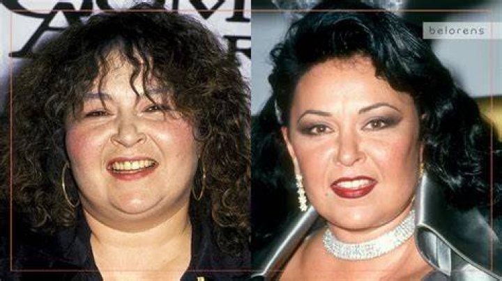 Transformations Of A Comedian: Roseanne Before And After Plastic Surgery