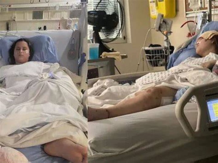 Two sisters are recovering from breast cancer, thanks to a family pet