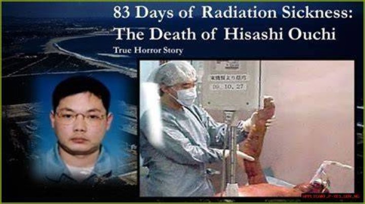 Unraveling The Tragic Tale Of Radiation Hisashi Ouchi