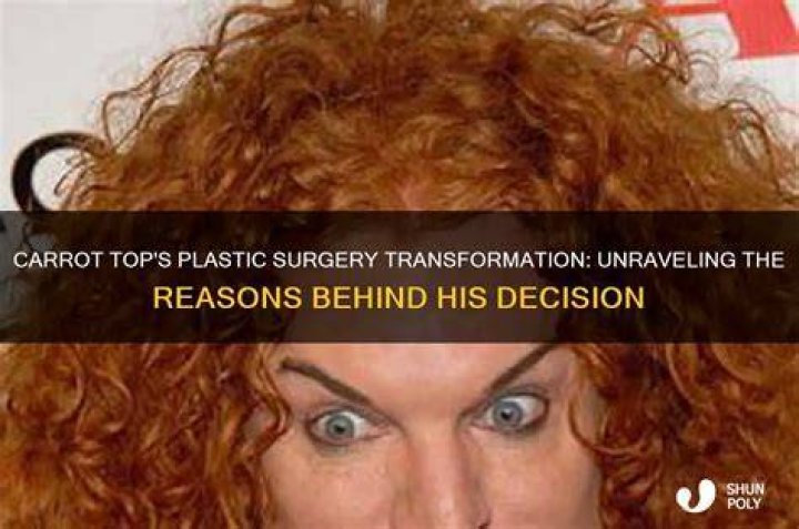 Unraveling The Vibrant World Of Carrot Top