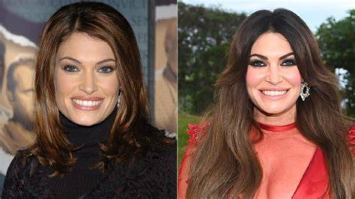 Unseen Before: Kimberly Guilfoyle's Face Unveiled