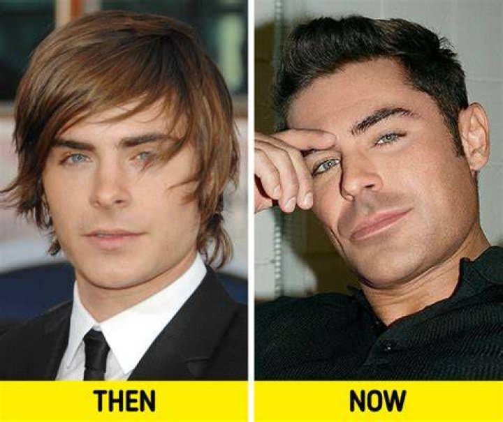 Unveiling Antony Starr: The Truth Behind His Plastic Surgery Rumors