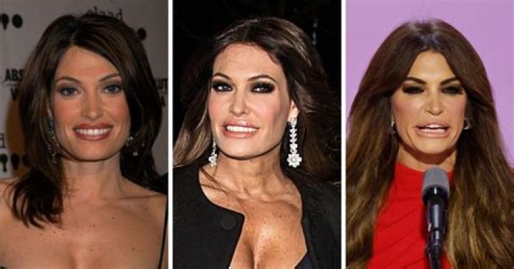 Unveiling Kimberly Guilfoyle's Plastic Surgery Transformation: Before And After Photos
