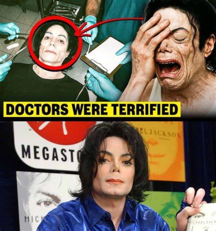 Unveiling Michael Jackson's Autopsy: Secrets And Revelations