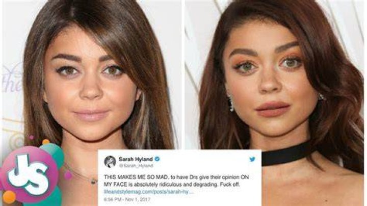 Unveiling Sarah Hyland's Plastic Surgery Journey: Discoveries And Insights
