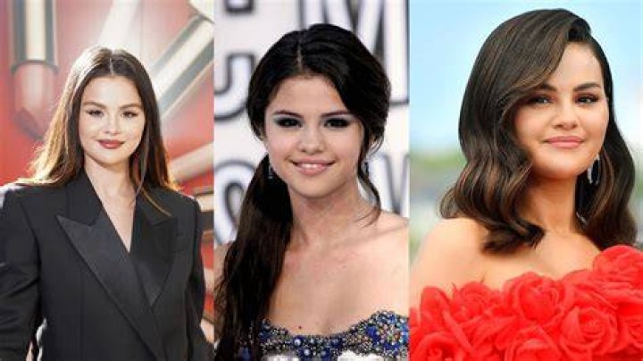 Unveiling Selena Gomez's Plastic Surgery Journey: Surprising Truths Revealed