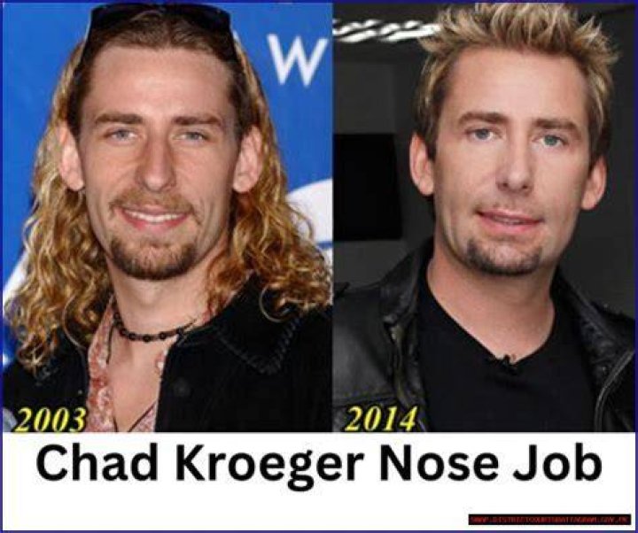 Unveiling The Hometown Of Chad Kroeger: A Comprehensive Guide