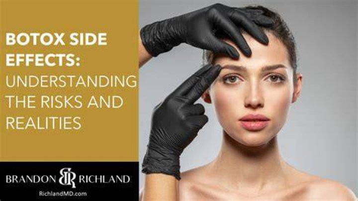 Unveiling The Risks And Realities: Can Botox Go Wrong?