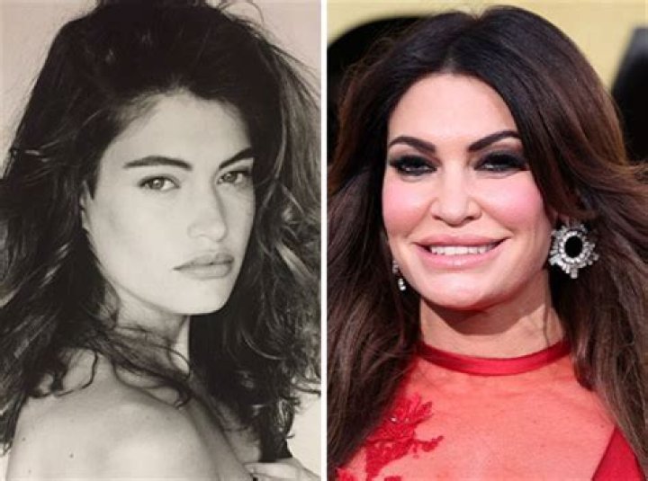 Unveiling The Transformation: Guilfoyle Before Plastic Surgery