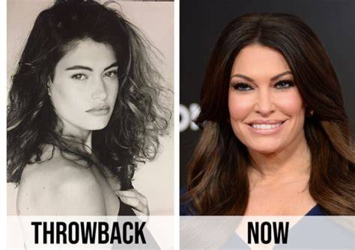 Unveiling The Transformation: Kimberly Guilfoyle's Plastic Surgery Journey Before And After