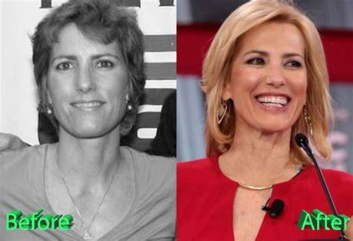 Unveiling The Truth Behind Laura Ingraham's Transformation