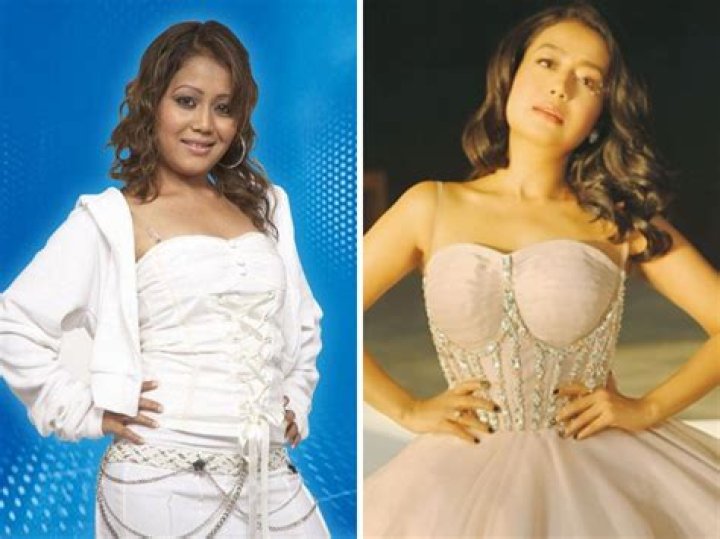 Unveiling The Truth: Neha Kakkar's Plastic Surgery Journey