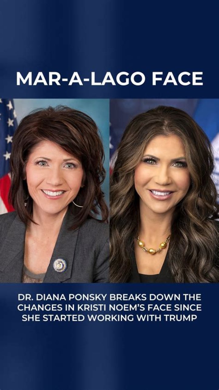 Unveiling The Truths Behind Susan Page's Plastic Surgery Journey: Discoveries And Insights