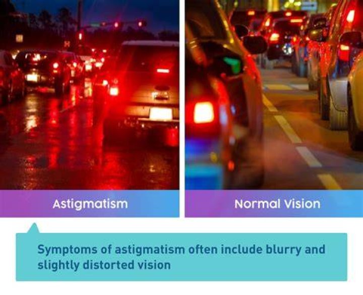 What Is Astigmatism & Everything You Need to Know &mdash; UNIQSO