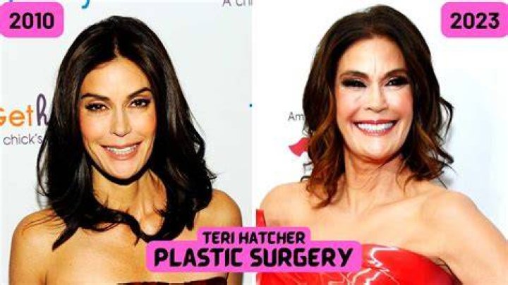 What Plastic Surgery Has Teri Polo Gotten? Body Measurements and Wiki