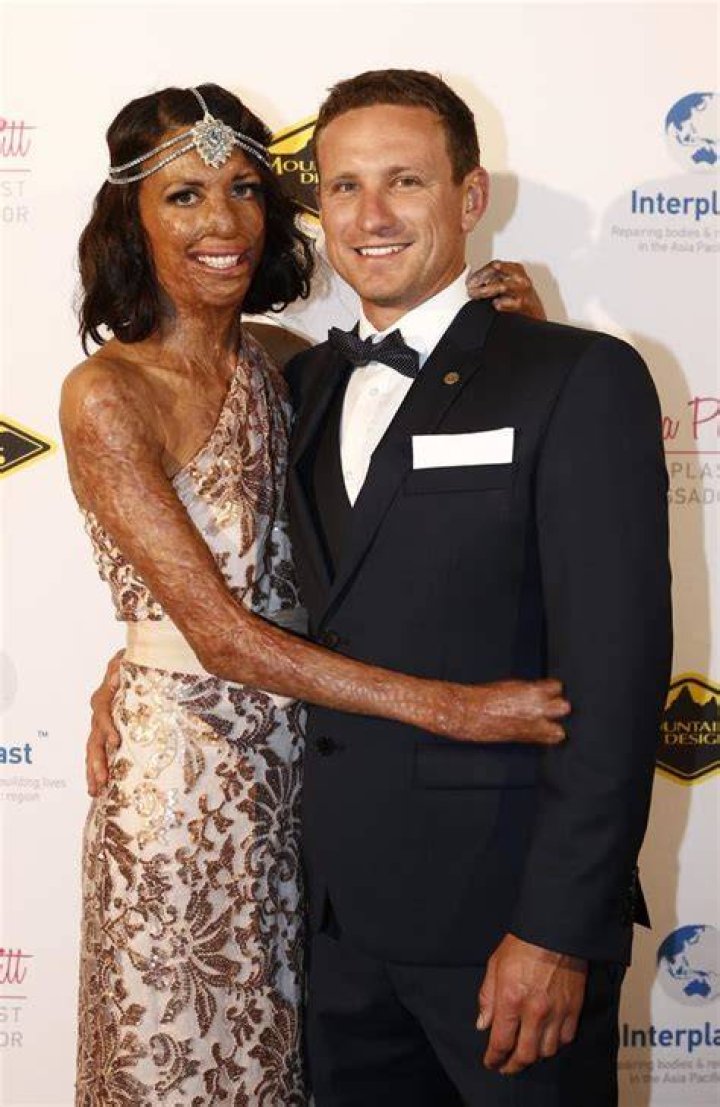 Who Is Turia Pitt Husband Michael Hoskin? Everything To Know About Him