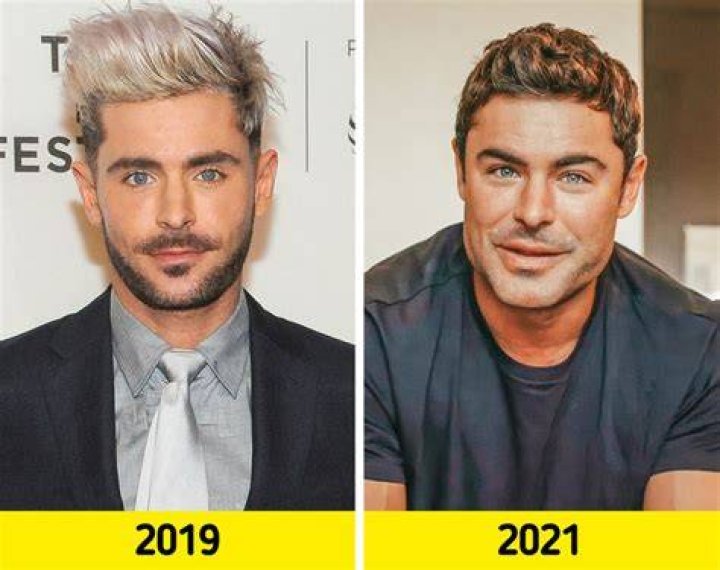Zac Efron's New Face: A Transformation Unveiled
